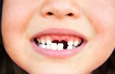 De mythe van 'Eerst-wisselen-dan-ortho'